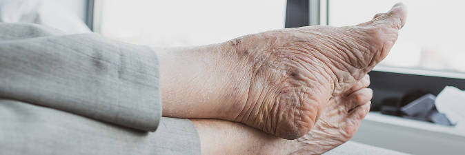 El cuidado del pie en la tercera edad