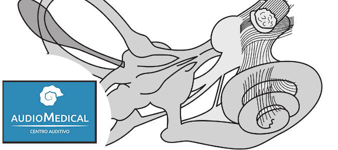 ¿Audífonos o amplificadores?